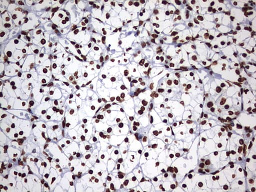 Monoclonal Mouse anti-Human HNRPM / HNRNPM Antibody (clone OTI1F6, aa1-261, IHC, WB)