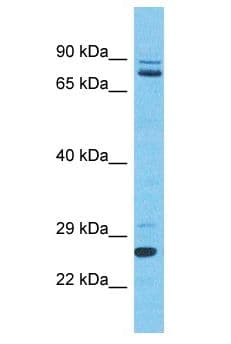 SLC2A4RG / GEF Antibody (aa197-246)