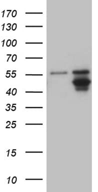 AGPAT9 / MAG1 Antibody (aa41-131, clone OTI3G3)