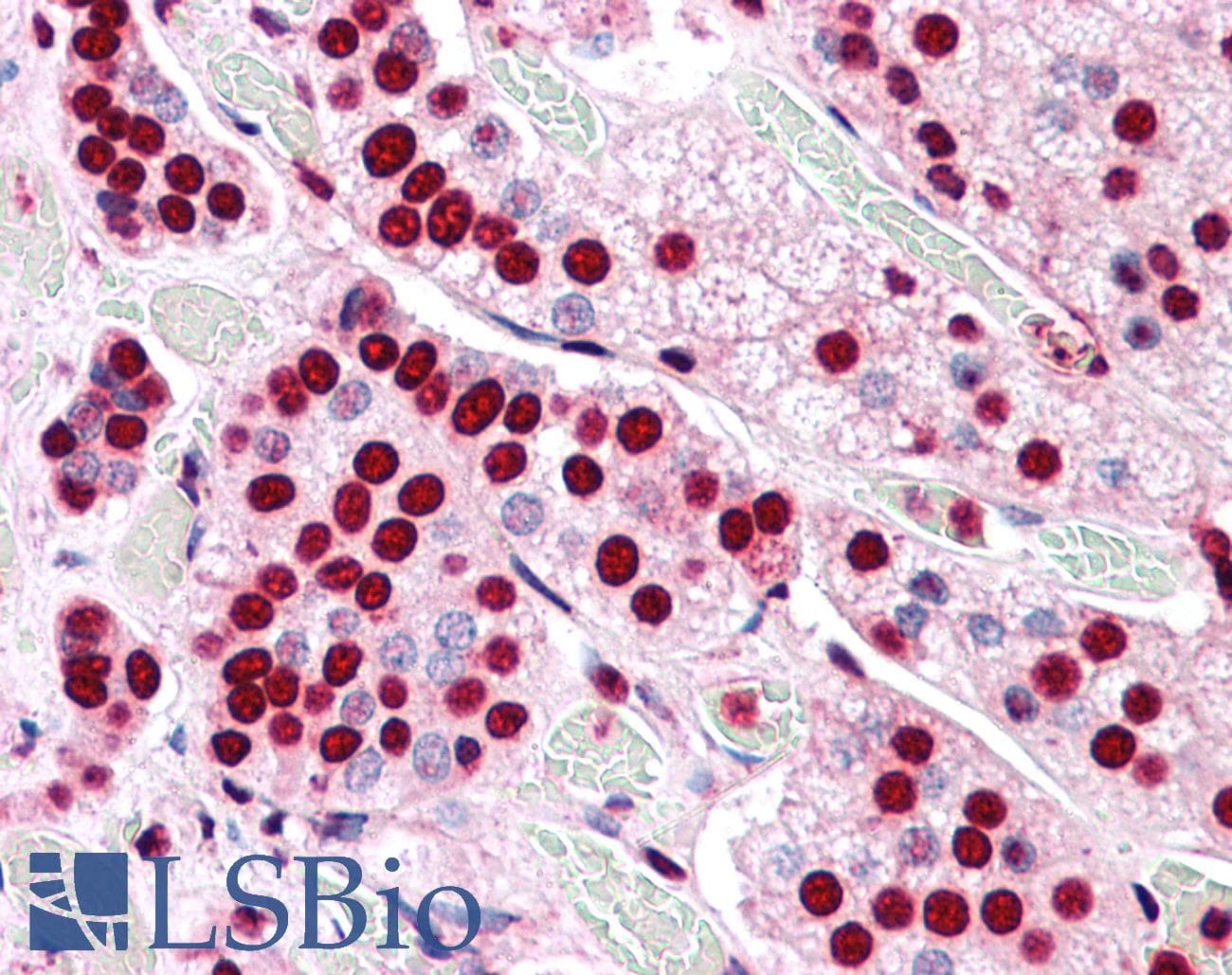 IHC-plus™ Polyclonal Rabbit anti-Human COMT Antibody (Internal, IHC)