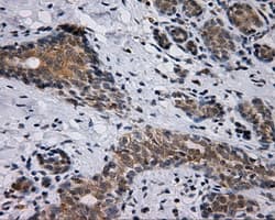 Monoclonal Mouse anti-Human BAP / SIL1 Antibody (clone OTI3B11, IHC, IF, WB)