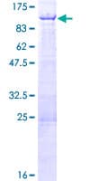 Human ZNF326 / Zfp326 Protein (Recombinant GST)