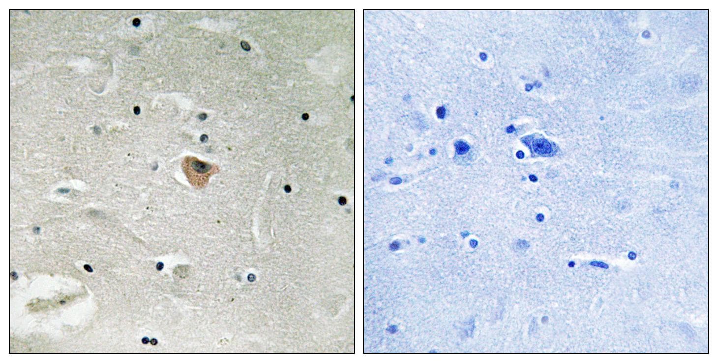 Polyclonal Rabbit anti-Human KIF13B / GAKIN Antibody (IHC)