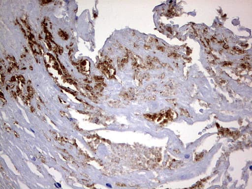 Monoclonal Mouse anti-Human CD63 Antibody (clone OTI2G6, IHC, WB)