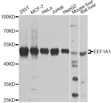 IHC-plus™ Polyclonal Rabbit anti-Human EEF1A1 Antibody (IHC, IF, WB)