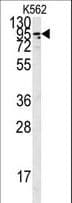 IHC-plus™ ACE2 / ACE-2 Antibody (aa773-805)