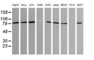 SOLO / SESTD1 Antibody (clone OTI7G4)