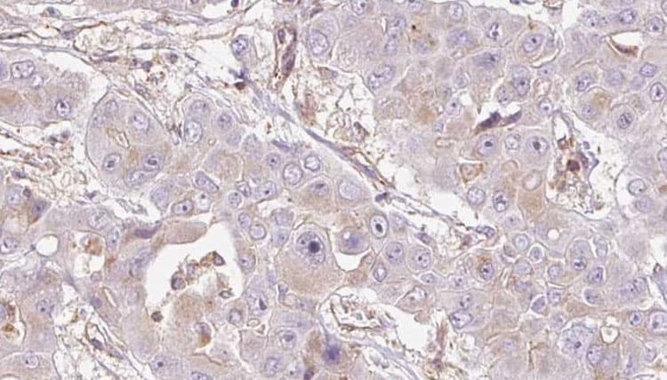 OR4D5 Antibody