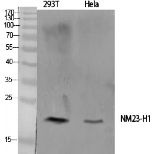 Polyclonal Rabbit anti-Human NME1 / NM23 Antibody (Internal, IHC, WB)