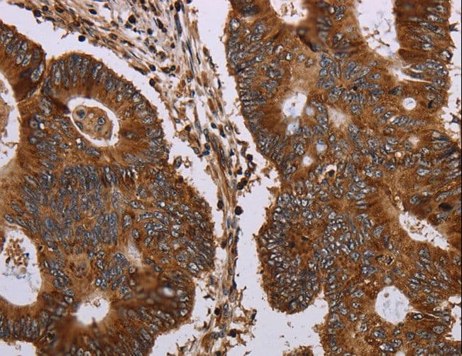 MAGEC2 / CT10 Antibody