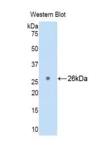 LY9 / CD229 Antibody (aa2-212)