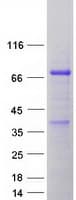 Human SMPD3 / NSMASE2 Protein (Recombinant Myc-DDK (Flag))