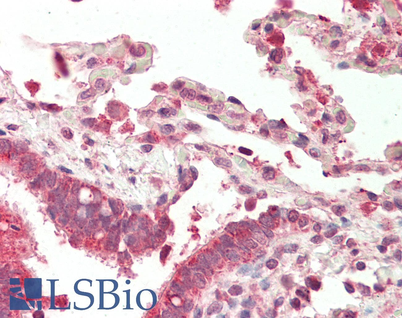 Polyclonal Rabbit anti-Human NFATC4 / NFAT3 Antibody (N-Terminus, IHC, WB)