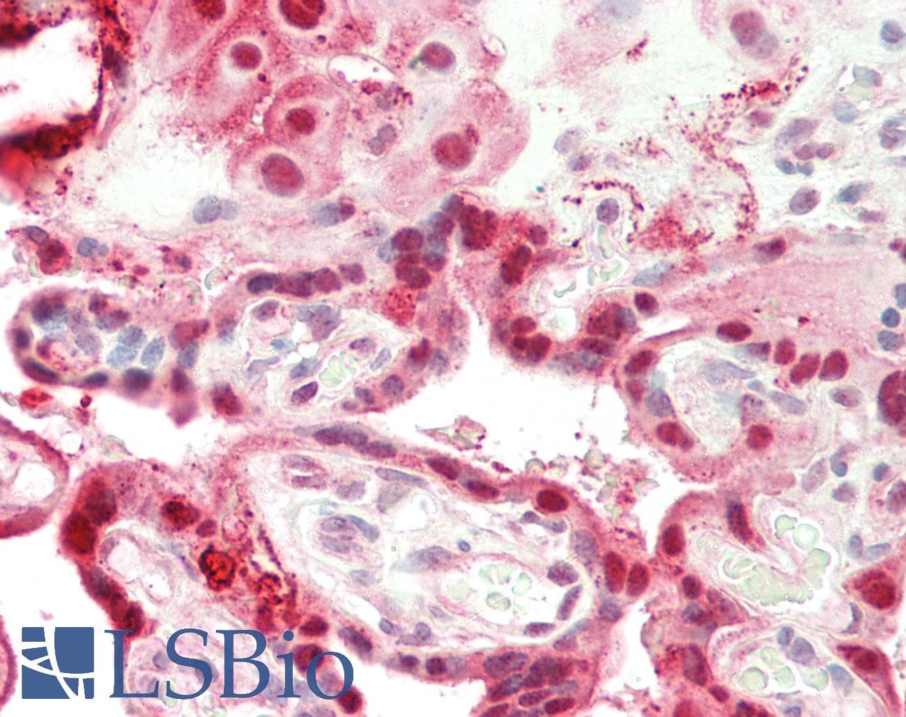 IHC-plus™ Polyclonal Rabbit anti-Human ANXA1 / Annexin A1 Antibody (aa129-158, IHC, WB)