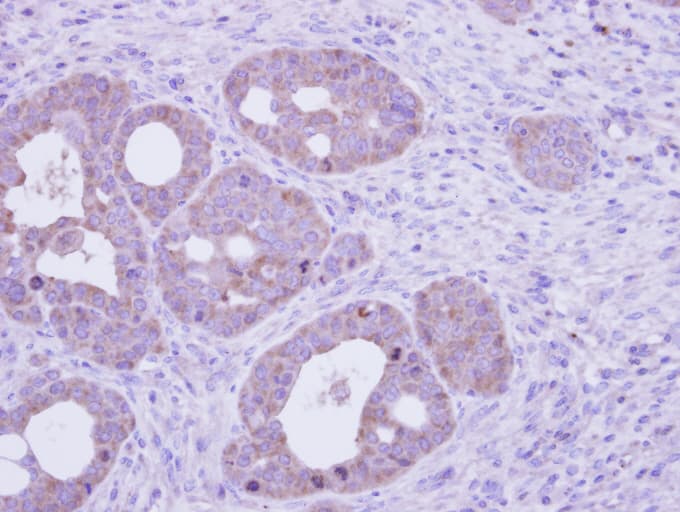 Polyclonal Rabbit anti-Human FTCD / 58K Golgi Protein Antibody (aa1-251, IHC, WB)