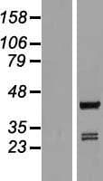 ARFIP1 Protein (Over-Expression Lysate Myc-DDK (Flag))