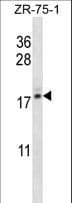 Polyclonal Rabbit anti-Human TP-2 / TNP2 Antibody (aa88-116, WB)