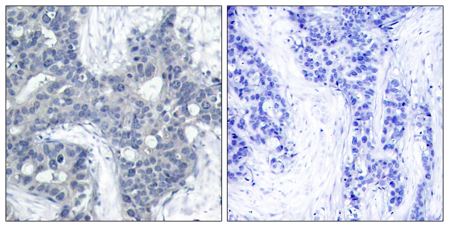 PTK2B / PYK2 Antibody (phospho-Tyr402)
