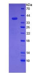 Rat HAMP / Hepcidin Protein (Recombinant His-GST)