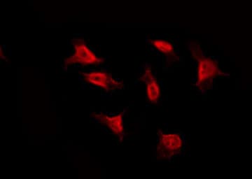 RPS3 / Ribosomal Protein S3 Antibody