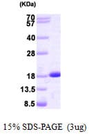 Human NME2 Protein (Recombinant)