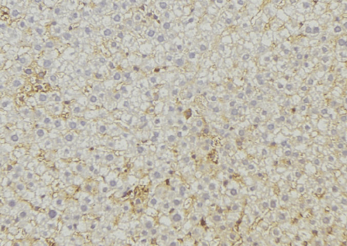 ABCC6 / MRP6 Antibody