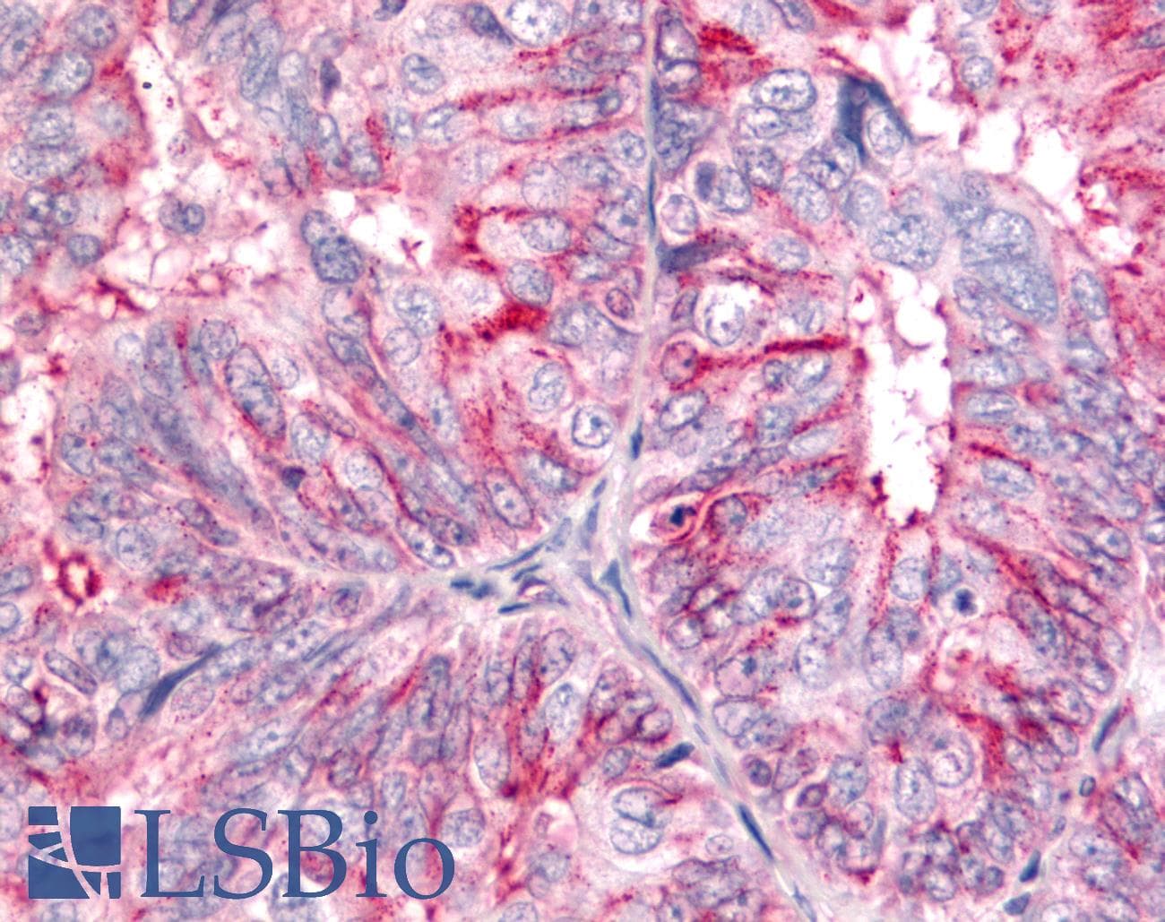 PathPlus™ ADGRB2 / BAI2 Antibody (N-Terminus)