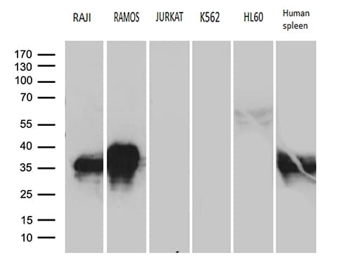 CD79B / CD79 Beta Antibody (clone OTI9H8)
