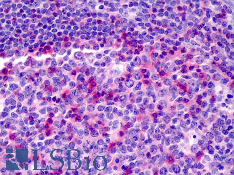 IHC-plus™ Monoclonal Mouse anti-Human CD69 Antibody (clone 8B6, IHC, WB)