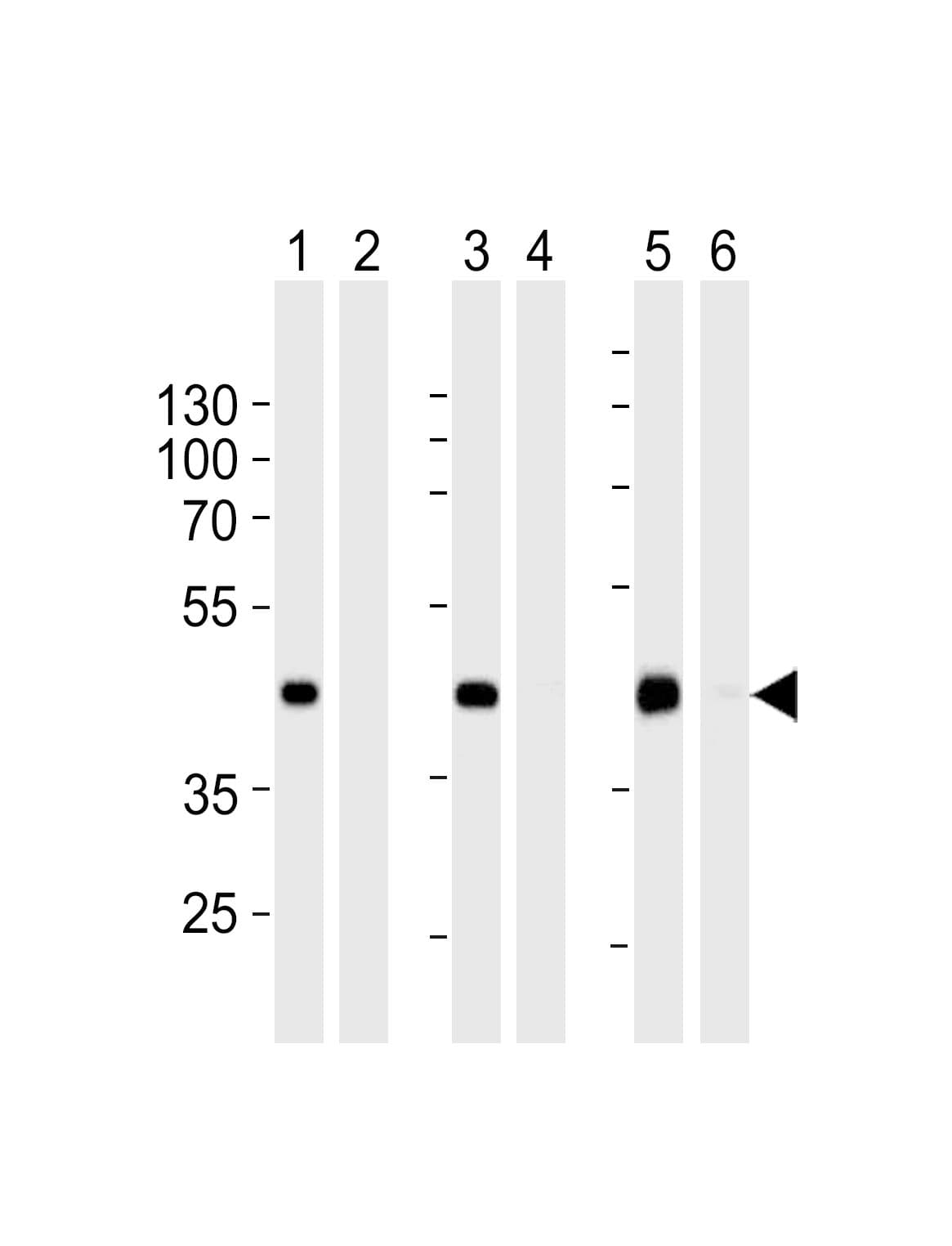 STEAP2 Antibody (aa229-258)