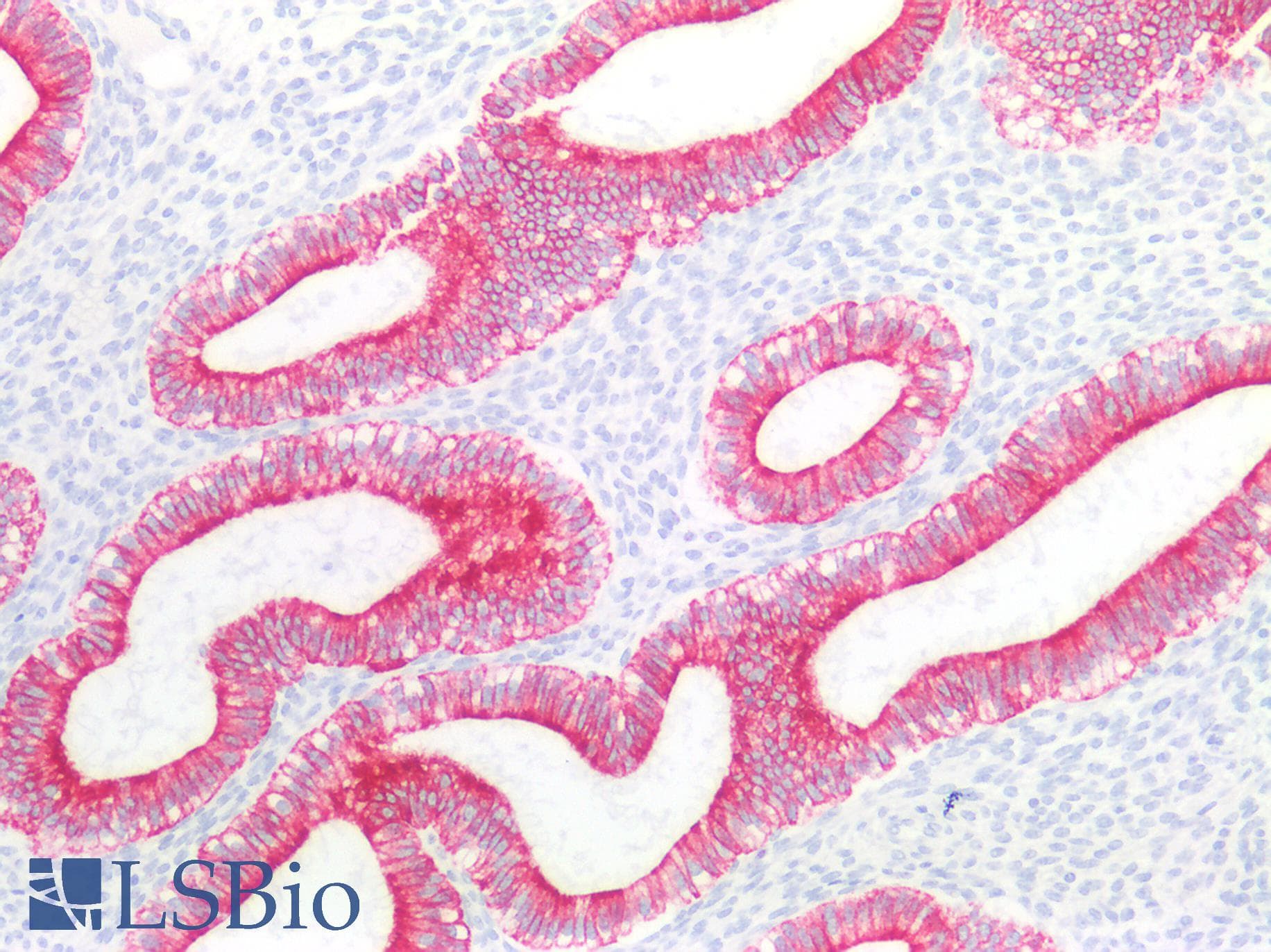 PathPlus™ KRT18 / CK18 / Cytokeratin 18 Antibody