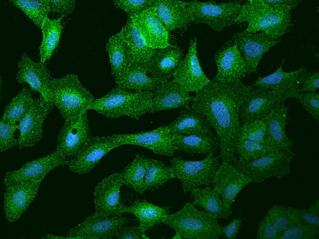 CD135 / FLT3 Antibody