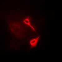 HAS3 Antibody