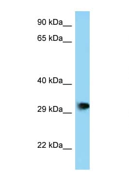 PHF23 Antibody (aa191-240)
