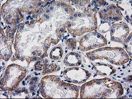 CTNNB1 / Beta Catenin Antibody (clone OTI9F6)