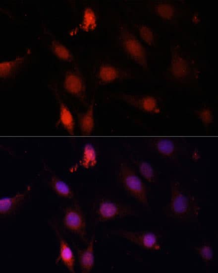 GBX2 Antibody