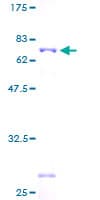Human GNA15 Protein (Recombinant GST)