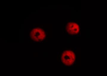 Polyclonal Rabbit anti-Human SOX9 Antibody (phospho-Ser181, IHC, IF, WB)