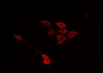 GALK1 / GK1 Antibody