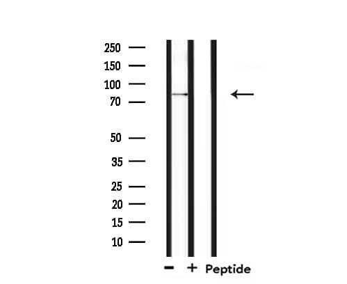 Polyclonal Rabbit anti-Human SENP5 Antibody (IHC, IF, WB)