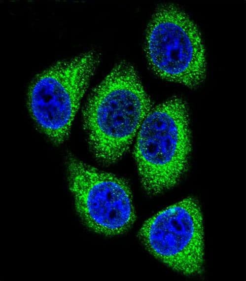 DEK Antibody (aa336-364)