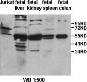 Polyclonal Rabbit anti-Human IL31RA Antibody (aa91-378, IHC, WB)