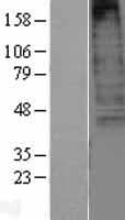 Human CXCR3 Protein (Over-Expression Lysate Myc-DDK (Flag))