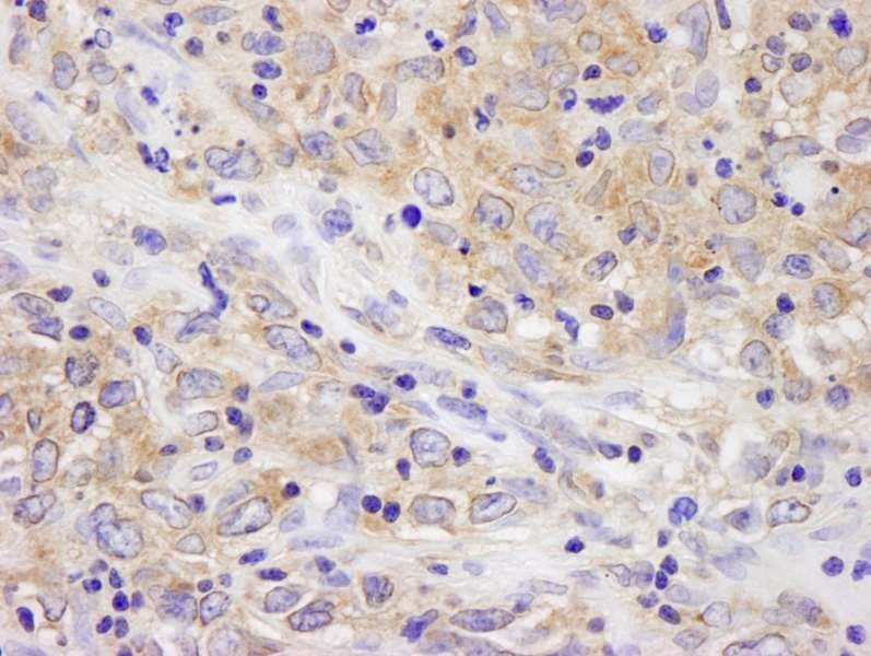 BRUCE / BIRC6 Antibody (aa4775-C-term)