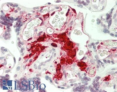 F13A1 / Factor XIIIa Antibody (clone 6F5, Carrier-free)