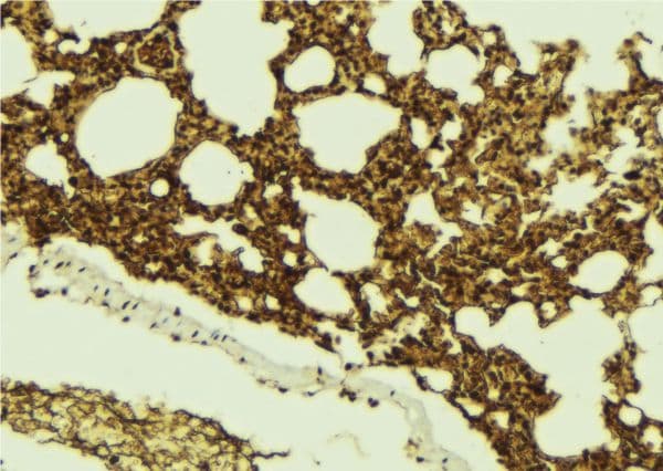 CHMP4B Antibody