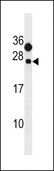 CLEC6A / Dectin 2 Antibody (aa137-163)