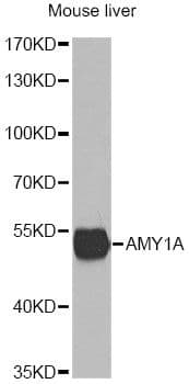 Polyclonal Rabbit anti-Human AMY1A / Salivary Amylase Antibody (IHC, WB)
