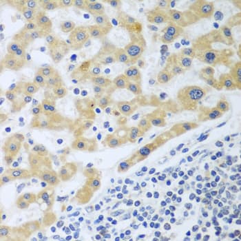 SHBG Antibody