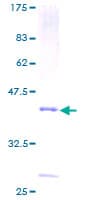 Human PLA2G2D Protein (Recombinant GST)